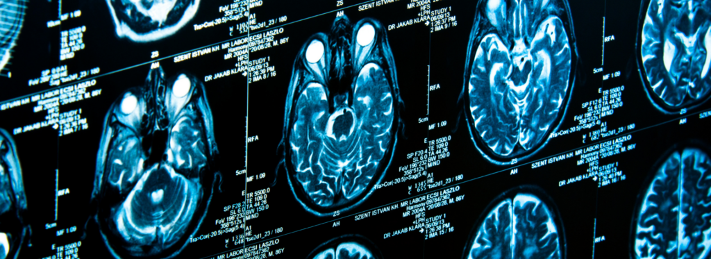 CHU Tivoli - Technologue ou infirmier.e en imagerie médicale